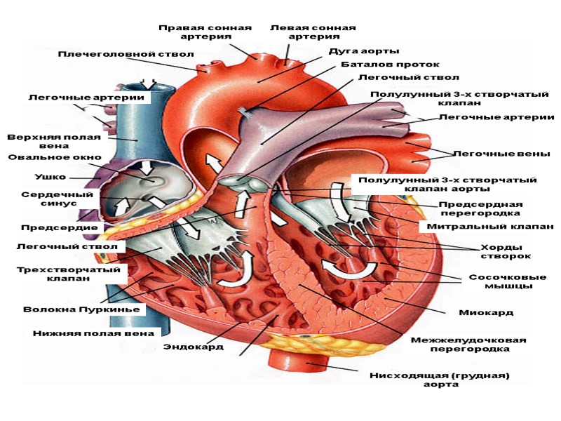 Дуга аорты Правая сонная  артерия Плечеголовной ствол Легочный ствол Баталов проток Легочные артерии